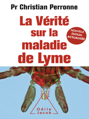cover image of La Vérité sur la maladie de Lyme
